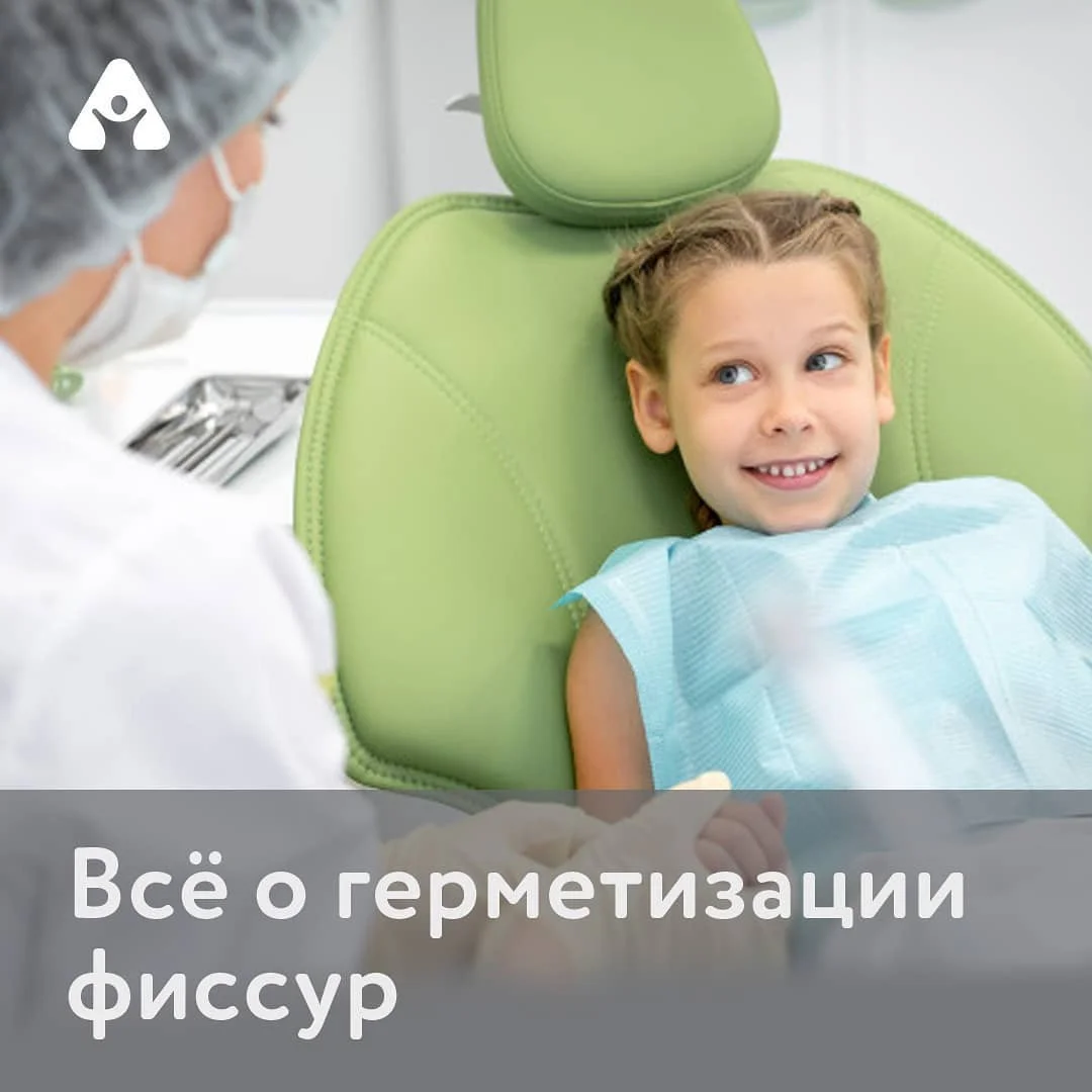 Герметизация фиссур — до