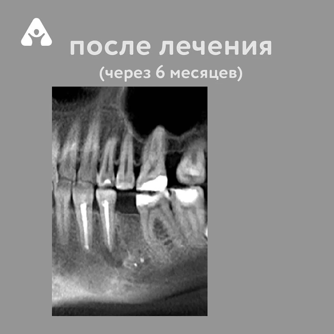 Исправляем ошибки за другими — после