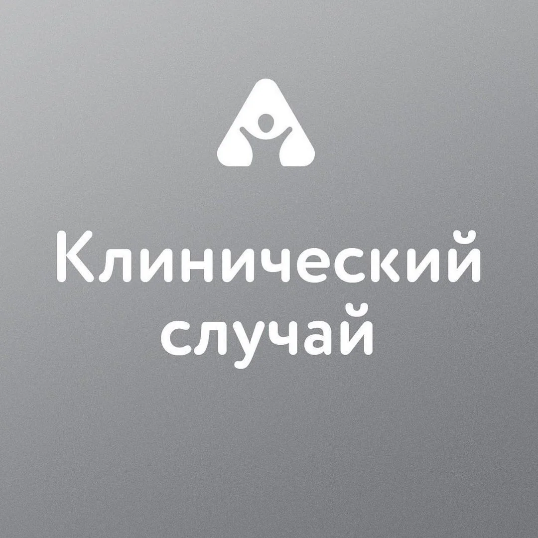 Имплантация зубов — до