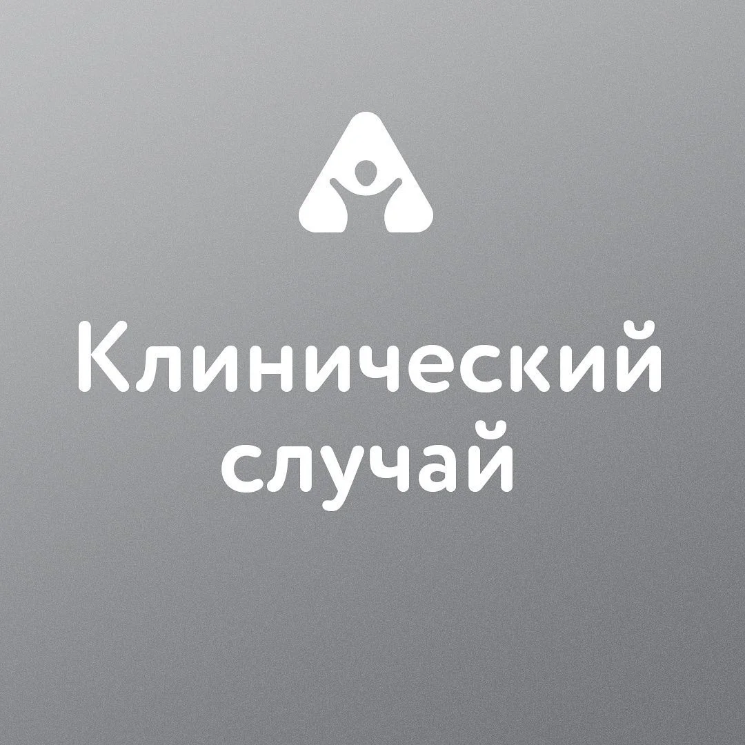Травма зуба — до