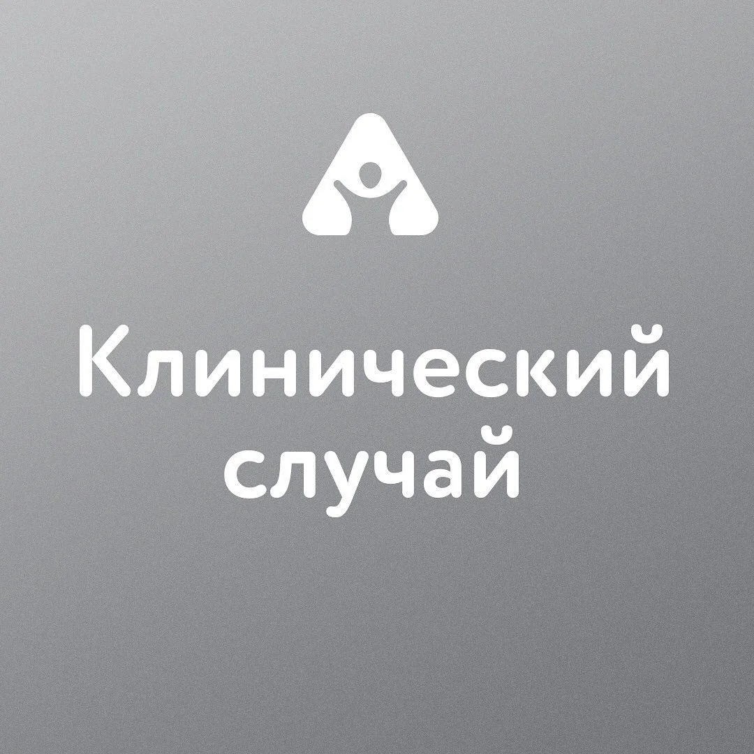 Лечение молочных зубов — до