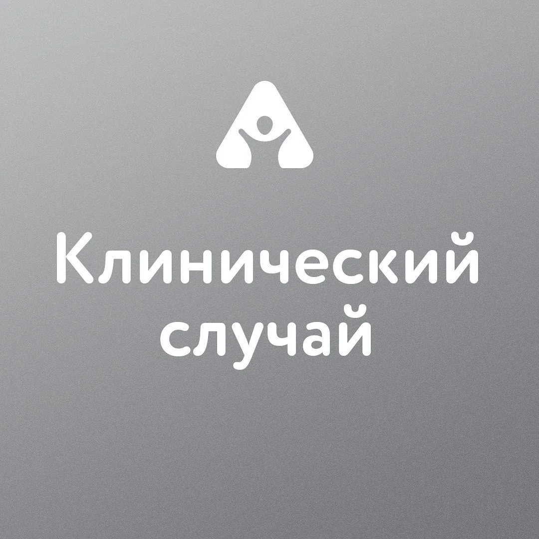 Исправление прикуса — до
